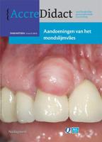 Aandoeningen van het mondslijmvlies (Paperback) - thumbnail