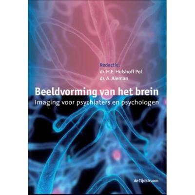 Beeldvorming van het brein (Hardback)
