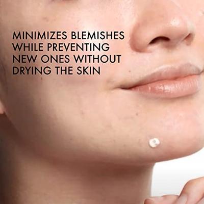 Vichy Normaderm S.O.S. Phytosolution Sulfur Anti-Spot Paste 20 ml