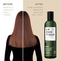 Lazartigue Clear Regulating Anti-Dandruff Shampoo Step 2 250ml - thumbnail