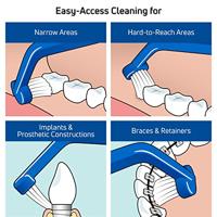 Tepe Implant Care - thumbnail
