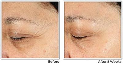 RoC Multi Correxion® Revive + Glow Daily Serum RoC Multi Correxion® Revive + Glow Daily Serum