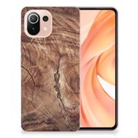 Xiaomi Mi 11 Lite | 11 Lite 5G NE | Bumper Hoesje | Tree Trunk - thumbnail