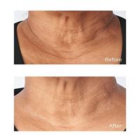 Perricone MD Sub D/Neck 59ml - thumbnail