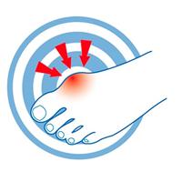 Epitact Hallux Valgus Beschermer - thumbnail