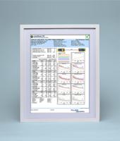 Stevige UTP-netwerkkabel categorie 6 Vention IKABL Zwart 10 m - thumbnail