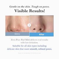 Medicube Zero Pore Mild Pad 155 g - thumbnail