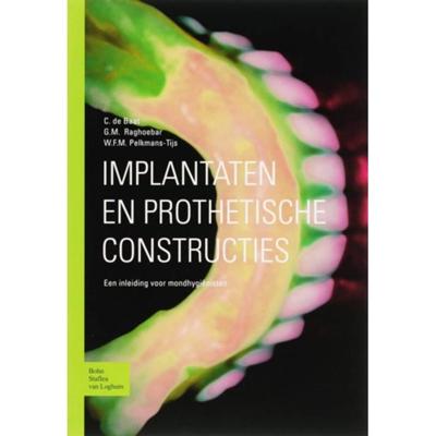 Implantaten en prothetische constructies (Paperback) Implantaten en prothetische constructies (Paperback)