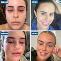 Gezicht & ooglid eczeem creme 50 Gram - thumbnail