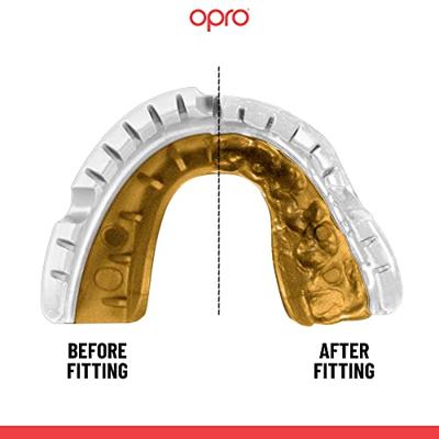 Opro 790006 Gold Ultra Fit Mouthguard Braces - White-Gold - SR Opro 790006 Gold Ultra Fit Mouthguard Braces - White-Gold - SR