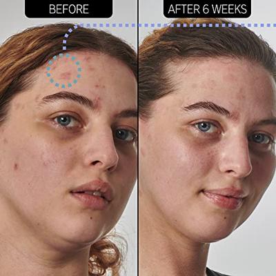 The Inkey List 10% Urea Moisturizer 50 ml The Inkey List 10% Urea Moisturizer 50 ml