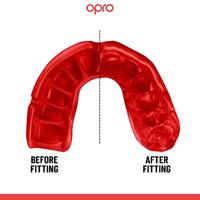 Opro 791001 UFC Platinum Elite Fit Mouthguard - Black-Gold-Red - SR - thumbnail