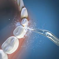 Waterpik WF-05 elektrische flosser Wit - thumbnail