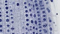 BRESSER Microscoop preparaten 10 stuks - thumbnail
