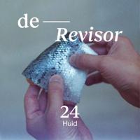 Huid - thumbnail