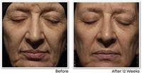 RoC Retinol Correxion Wrinkle Correct Night Cream 30ml - thumbnail