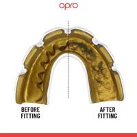 Opro 790001 Instant Custom Dentist Fit Mouthguard Braces - Navy-Gold - SR - thumbnail