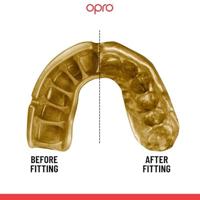 Opro 790007 Silver Superior Fit Mouthguard - No colour - SR - thumbnail