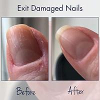 Herome Exit Damaged Nails - thumbnail
