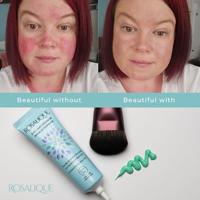 Rosalique Anti redness miracle formula 30 Milliliter - thumbnail