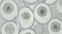 BRESSER Microscoop preparaten 10 stuks - thumbnail