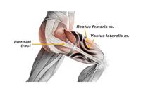 Bodyvine Lichtgewicht Bovenbeen Bandage Dijbeenbandage Sport (2 stuks) - S - Links - thumbnail
