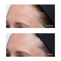 Perricone MD Hyaluronic Intensive Moisturizer 30ml - thumbnail
