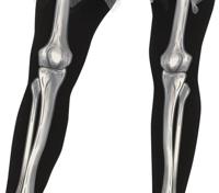 Ballerina Skelet Met Tutu Zwart Vrouw - thumbnail