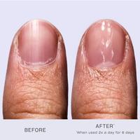 OPI Nail Envy Nail Strengthener 15ml - thumbnail