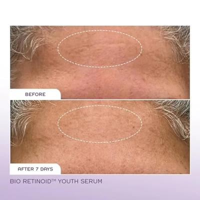 REN Clean Skincare Bio Retinoid Youth Serum 30ml