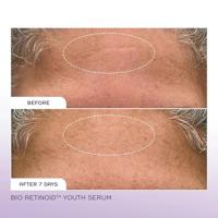 REN Clean Skincare Bio Retinoid Youth Serum 30ml - thumbnail