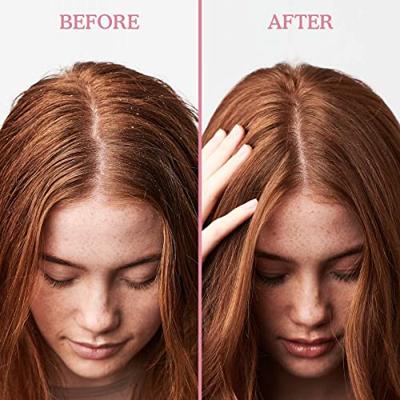 Umberto Giannini Scalp Restore Anti-roos Conditioner