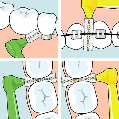 TePe Angle Interdentale Ragers Mixed Pack