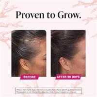 Viviscal Hair Growth Tablets Women - thumbnail