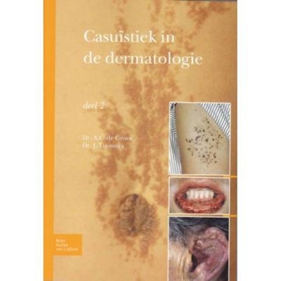 Casuïstiek in de dermatologie (Paperback)
