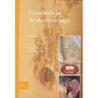 Casuïstiek in de dermatologie (Paperback) - thumbnail