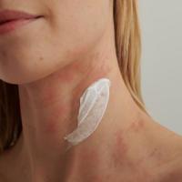 Dado Sens Extroderm Intensive Cream 50 ml - thumbnail