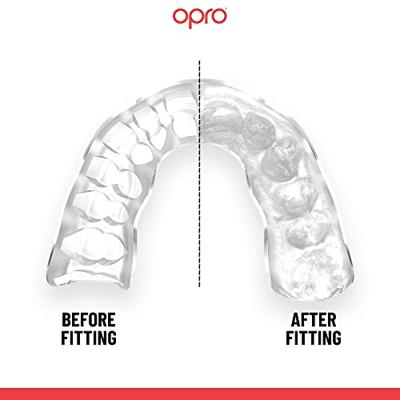 Opro 790000 Instant Custom Dentist Fit Mouthguard - Black-White - SR Opro 790000 Instant Custom Dentist Fit Mouthguard - Black-White - SR
