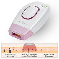 ProfiCare PC-IPL 3024 Roze, Wit - thumbnail