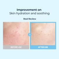 Torriden Dive In Low Molecular Hyaluronic Acid Multi Pad 160 ml - thumbnail