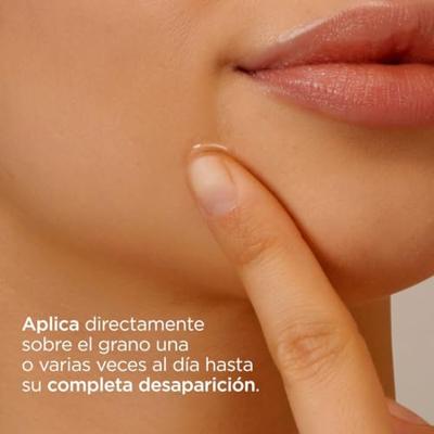 Acne-behandeling Isdin 690014020 Gel