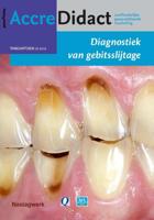 Diagnostiek van gebitsslijtage (Paperback) - thumbnail