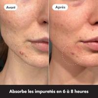 Hero Mighty Patch Original - thumbnail