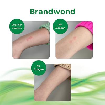 Alhydran Wondnabehandelingsgel
