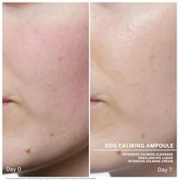 Babor SOS Calming Ampoule Concentrates 14ml Gerichte behandeling Dames - thumbnail