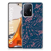 Xiaomi 11T | 11T Pro | TPU Case | Palm Leaves - thumbnail