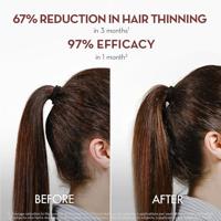 Klorane Sérum Antichute à la Quinine 100ml - thumbnail