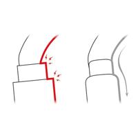 Petzl Sm'D Carabine Yellow - thumbnail