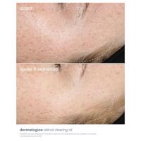 Lichaamsolie Dermalogica 30 L (1 Stuks) - thumbnail