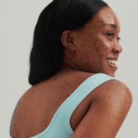 Dado Sens Purderm Normalizing Cream 50 ml - thumbnail